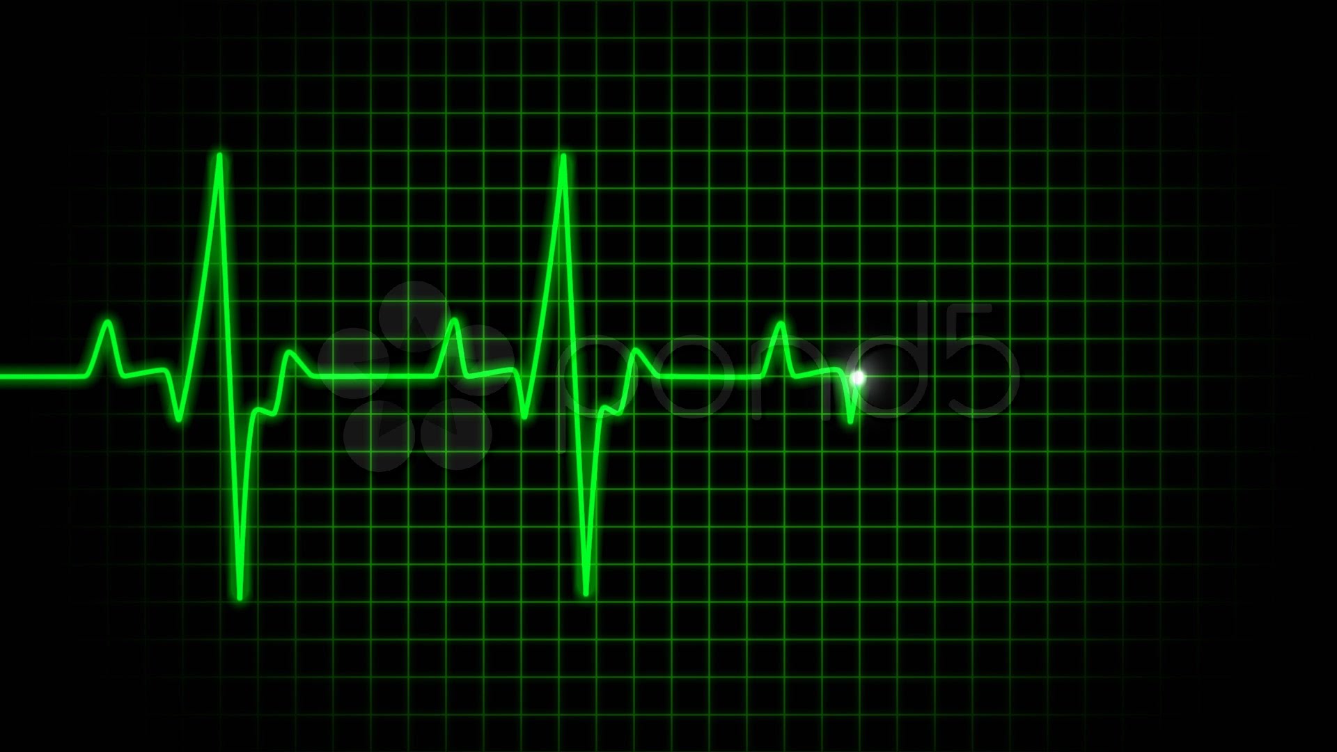 DYSRHYTHMIA INTERPRETATION & THERAPEUTIC MODALITIES DAY 1